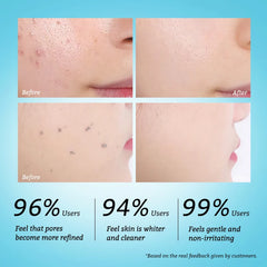 RtopR Facial Exfoliating Gel Facial Clean Cream Facial Scrub Blackhead Grease Dirt Oil Control Repairs Evens Tone Pore Tighten